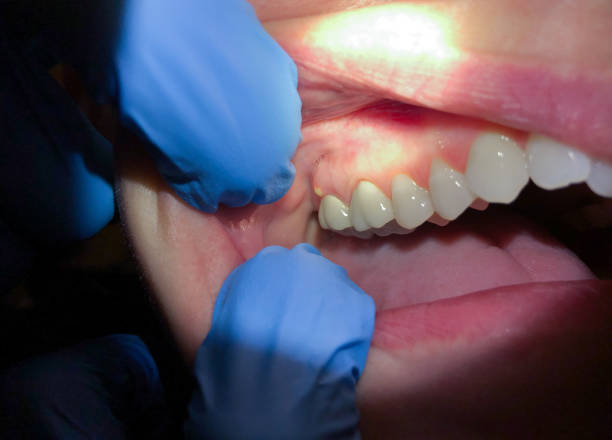 Best Emergency Treatment for Jaw Pain or Injury in Haughton, LA