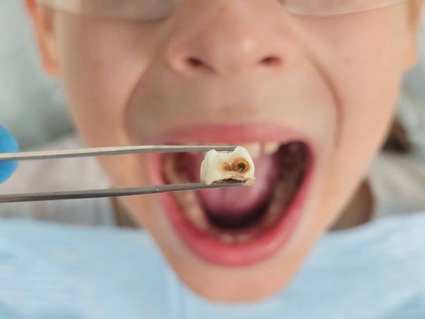Best Weekend Emergency Dental Services in Haughton, LA